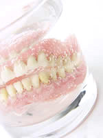 Dental Denture